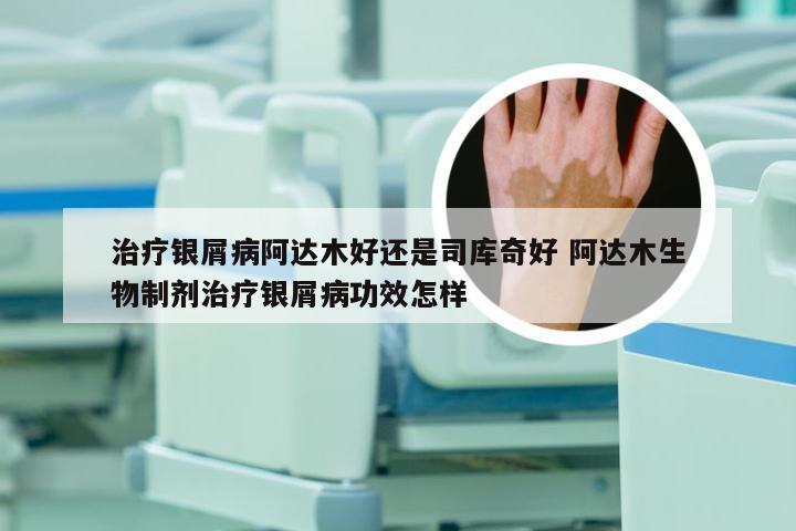 治疗银屑病阿达木好还是司库奇好 阿达木生物制剂治疗银屑病功效怎样