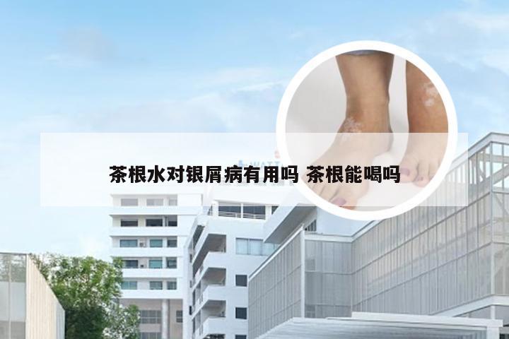 茶根水对银屑病有用吗 茶根能喝吗
