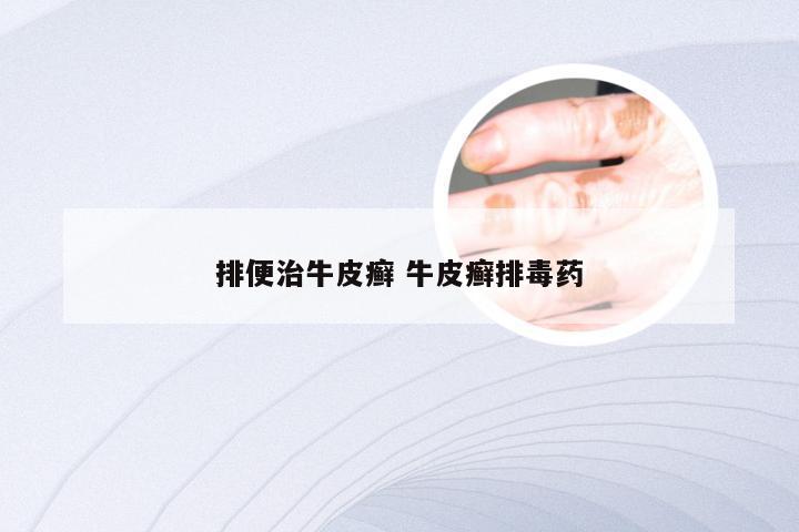 排便治牛皮癣 牛皮癣排毒药