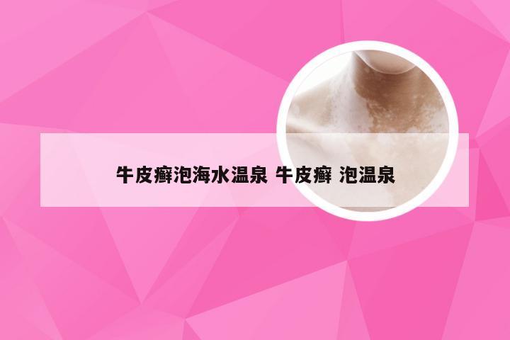 牛皮癣泡海水温泉 牛皮癣 泡温泉