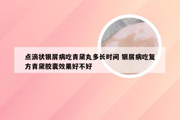 点滴状银屑病吃青黛丸多长时间 银屑病吃复方青黛胶囊效果好不好