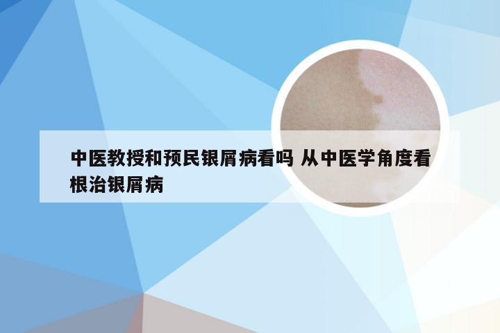 中医教授和预民银屑病看吗 从中医学角度看根治银屑病