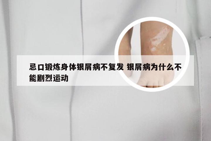 忌口锻炼身体银屑病不复发 银屑病为什么不能剧烈运动