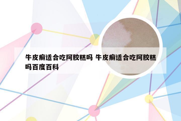 牛皮癣适合吃阿胶糕吗 牛皮癣适合吃阿胶糕吗百度百科
