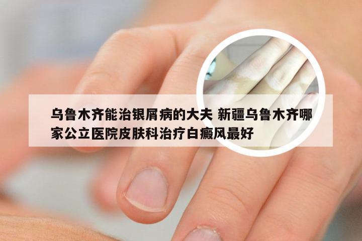 乌鲁木齐能治银屑病的大夫 新疆乌鲁木齐哪家公立医院皮肤科治疗白癜风最好