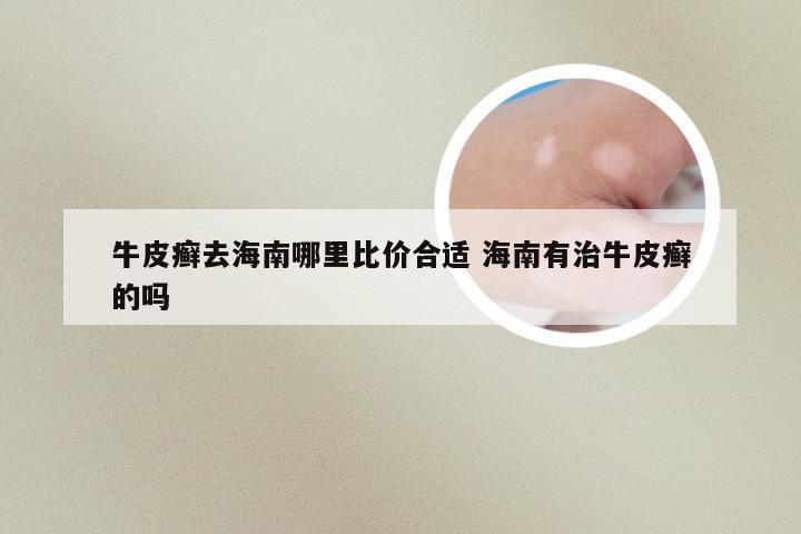 牛皮癣去海南哪里比价合适 海南有治牛皮癣的吗