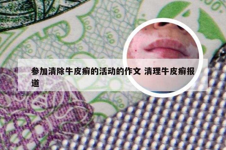 参加清除牛皮癣的活动的作文 清理牛皮癣报道