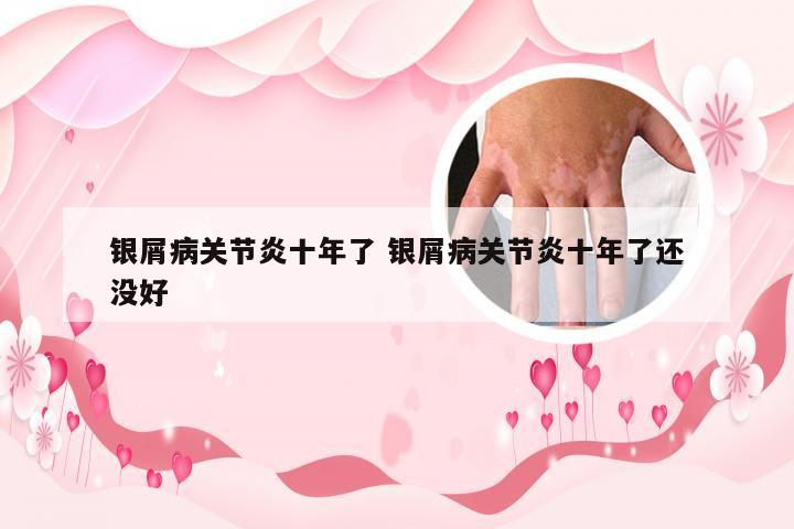 银屑病关节炎十年了 银屑病关节炎十年了还没好