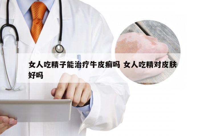 女人吃精子能治疗牛皮癣吗 女人吃精对皮肤好吗