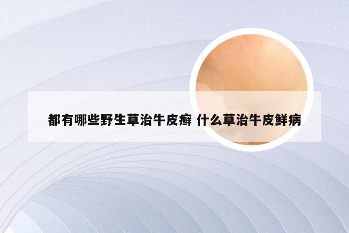 都有哪些野生草治牛皮癣 什么草治牛皮鲜病