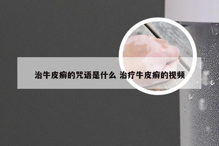 治牛皮癣的咒语是什么 治疗牛皮癣的视频