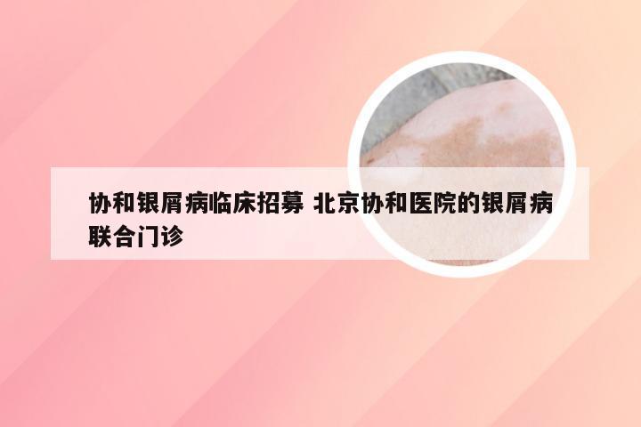 协和银屑病临床招募 北京协和医院的银屑病联合门诊