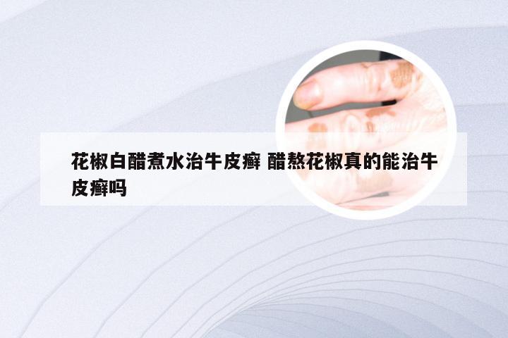 花椒白醋煮水治牛皮癣 醋熬花椒真的能治牛皮癣吗