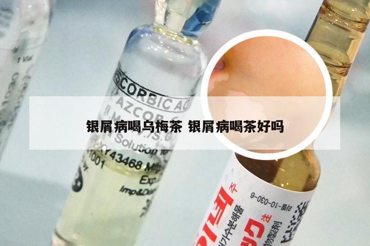 银屑病喝乌梅茶 银屑病喝茶好吗