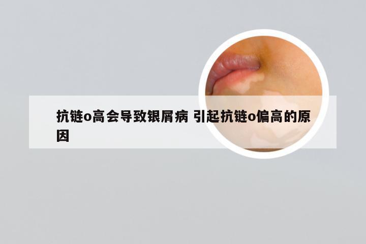 抗链o高会导致银屑病 引起抗链o偏高的原因