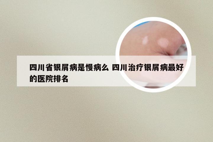 四川省银屑病是慢病么 四川治疗银屑病最好的医院排名