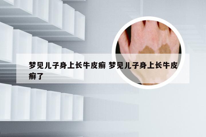 梦见儿子身上长牛皮癣 梦见儿子身上长牛皮癣了