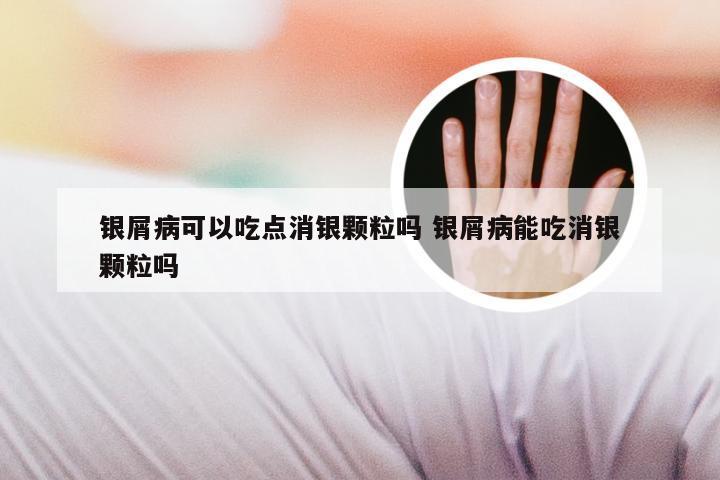 银屑病可以吃点消银颗粒吗 银屑病能吃消银颗粒吗