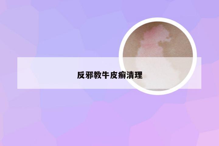 反邪教牛皮癣清理