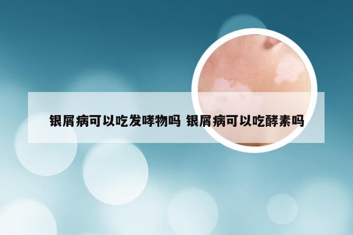 银屑病可以吃发哮物吗 银屑病可以吃酵素吗