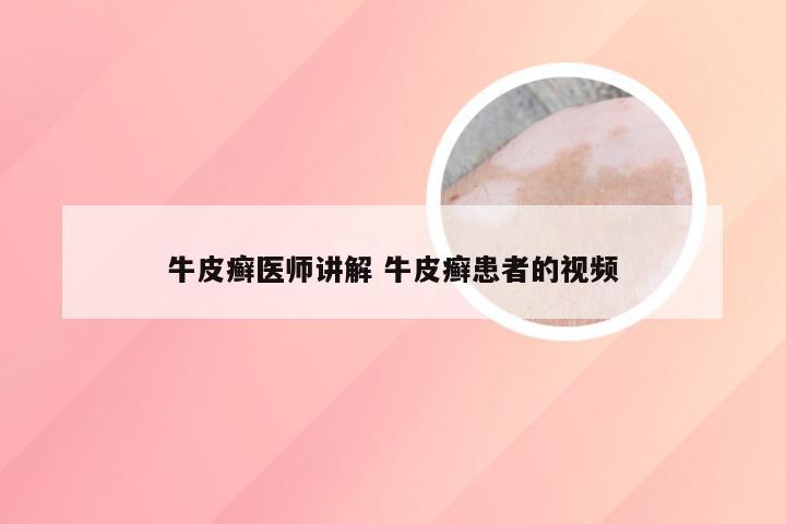 牛皮癣医师讲解 牛皮癣患者的视频