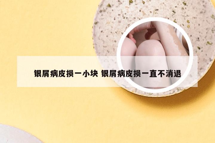 银屑病皮损一小块 银屑病皮损一直不消退