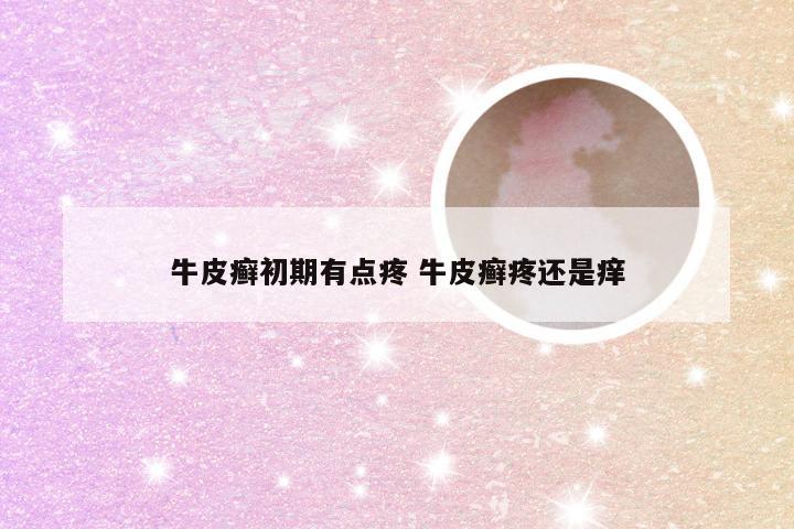 牛皮癣初期有点疼 牛皮癣疼还是痒