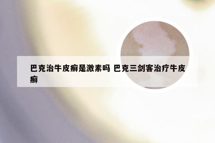巴克治牛皮癣是激素吗 巴克三剑客治疗牛皮癣
