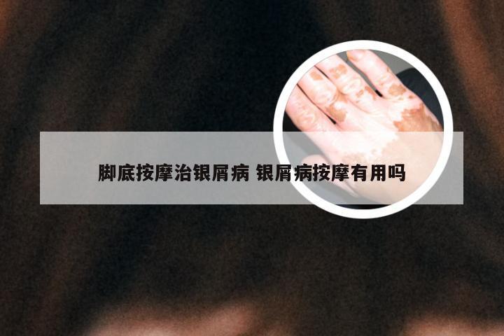 脚底按摩治银屑病 银屑病按摩有用吗