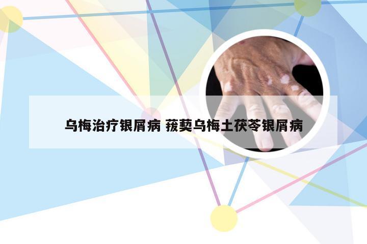 乌梅治疗银屑病 菝葜乌梅土茯苓银屑病