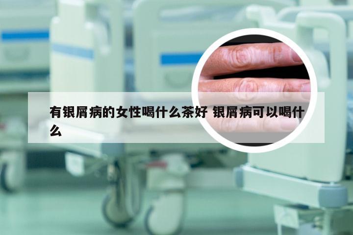 有银屑病的女性喝什么茶好 银屑病可以喝什么