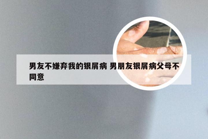 男友不嫌弃我的银屑病 男朋友银屑病父母不同意