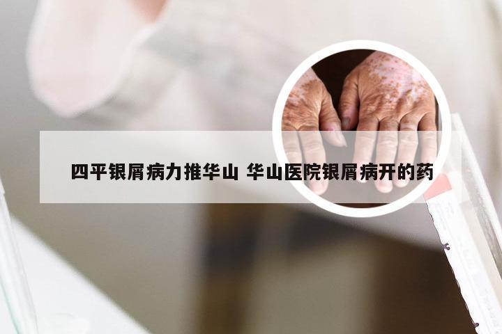 四平银屑病力推华山 华山医院银屑病开的药