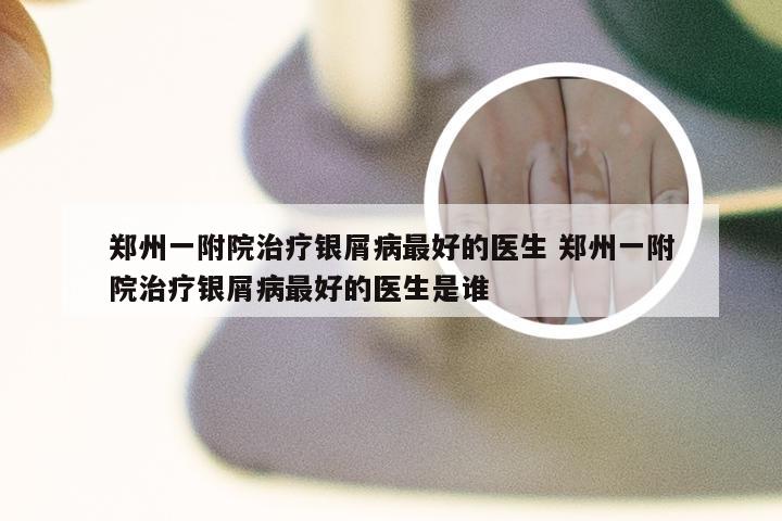 郑州一附院治疗银屑病最好的医生 郑州一附院治疗银屑病最好的医生是谁