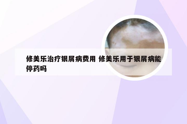 修美乐治疗银屑病费用 修美乐用于银屑病能停药吗