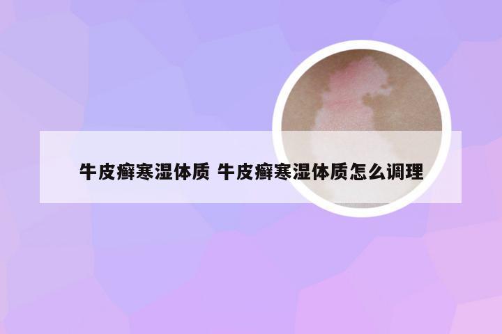 牛皮癣寒湿体质 牛皮癣寒湿体质怎么调理