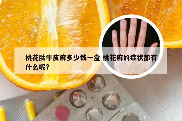 桃花肽牛皮癣多少钱一盒 桃花癣的症状都有什么呢?