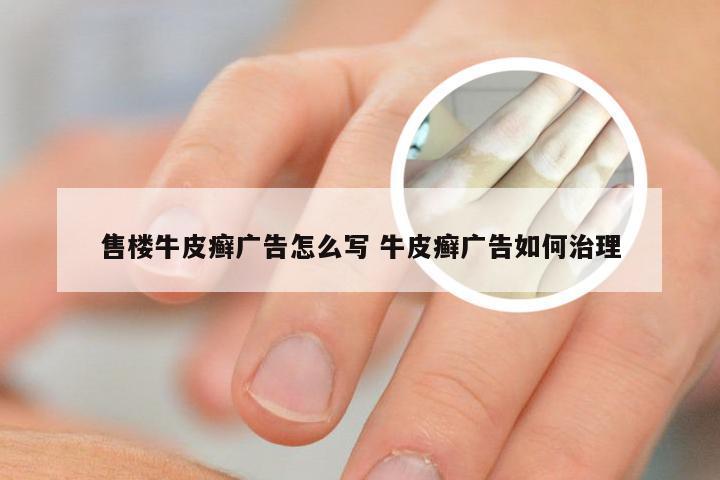 售楼牛皮癣广告怎么写 牛皮癣广告如何治理