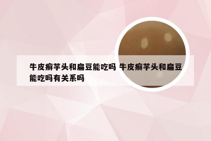 牛皮癣芋头和扁豆能吃吗 牛皮癣芋头和扁豆能吃吗有关系吗