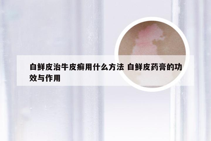 白鲜皮治牛皮癣用什么方法 白鲜皮药膏的功效与作用
