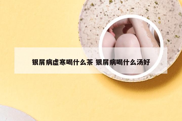 银屑病虚寒喝什么茶 银屑病喝什么汤好
