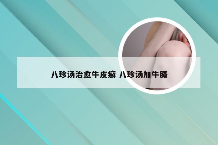 八珍汤治愈牛皮癣 八珍汤加牛膝