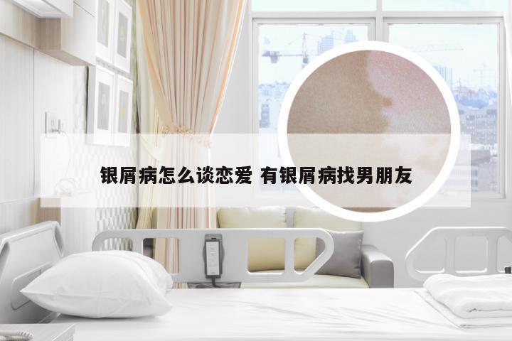 银屑病怎么谈恋爱 有银屑病找男朋友