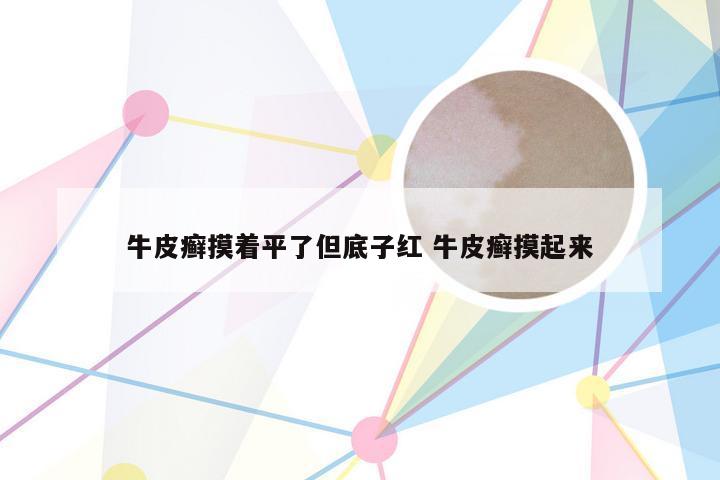 牛皮癣摸着平了但底子红 牛皮癣摸起来