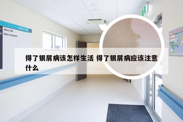 得了银屑病该怎样生活 得了银屑病应该注意什么