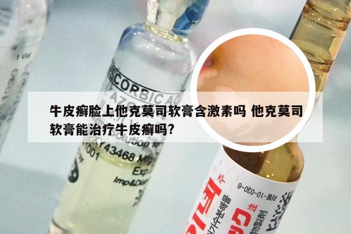 牛皮癣脸上他克莫司软膏含激素吗 他克莫司软膏能治疗牛皮癣吗?