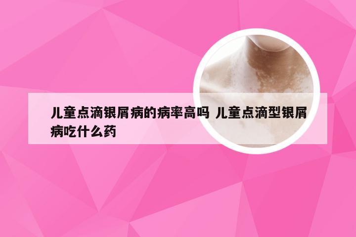 儿童点滴银屑病的病率高吗 儿童点滴型银屑病吃什么药
