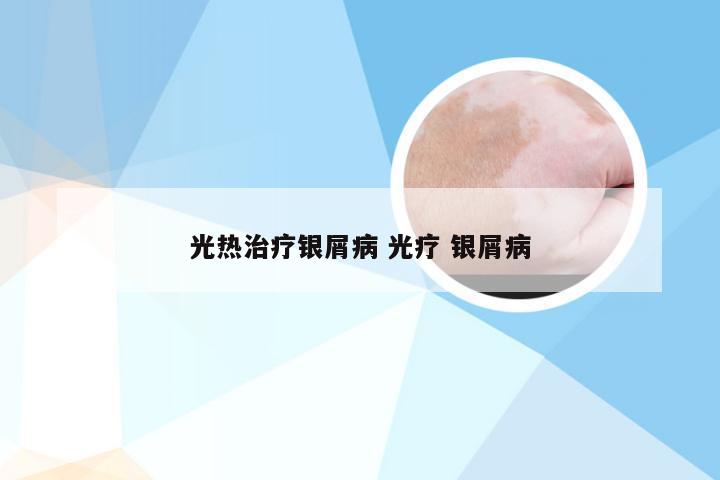 光热治疗银屑病 光疗 银屑病