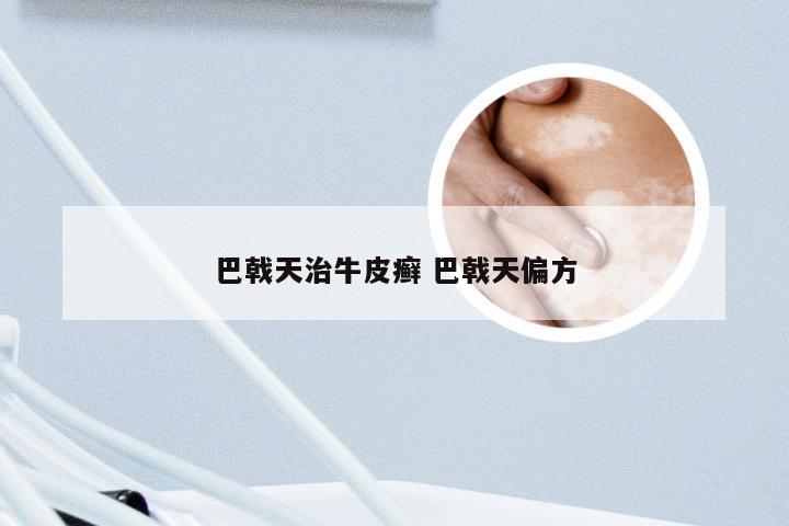 巴戟天治牛皮癣 巴戟天偏方