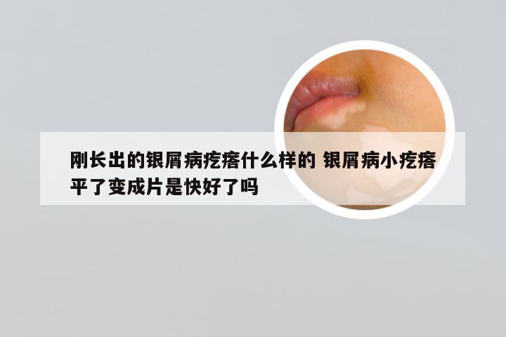刚长出的银屑病疙瘩什么样的 银屑病小疙瘩平了变成片是快好了吗